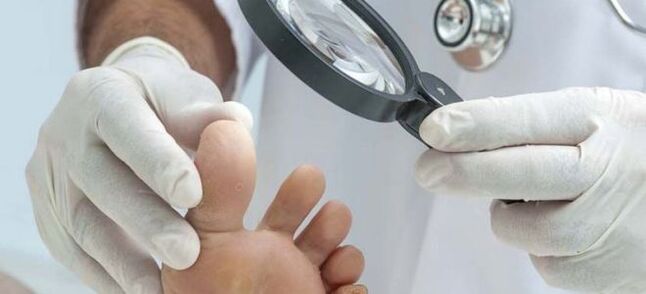 Vyšetrenia pred začatím liečby hubami